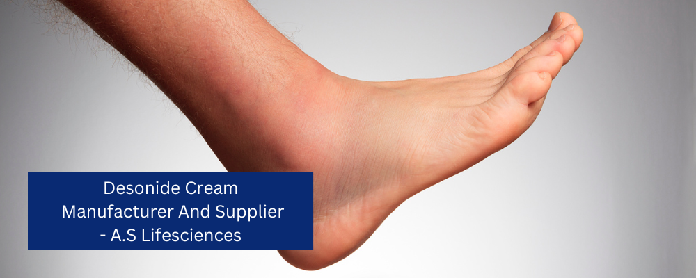 Desonide is a drug used for the treatment of various skin conditions, including contact dermatitis, seborrheic dermatitis, atopic dermatitis and psoriasis. It is available in various forms such as ointment and lotion. A.S. Lifesciences is a leading desonide cream manufacturer and supplier that offers cost effective solutions for various forms of skin disorders. Our products are formulated using high quality ingredients to ensure safety and efficacy.