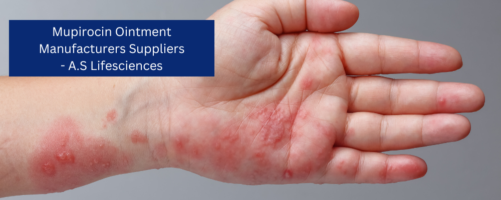 A.S. Lifesciences, a trusted PCD Pharma company in India, is a major supplier and manufacturer of Mupirocin Ointment IP. They are focused on providing high quality ingredients for the manufacturing of this ointment. A.S. Lifesciences pharma franchise company provides an opportunity to own exclusive rights for local market areas through their PCD Pharma Franchise program for medicines like Mupirocin Cream and Ointment IP.